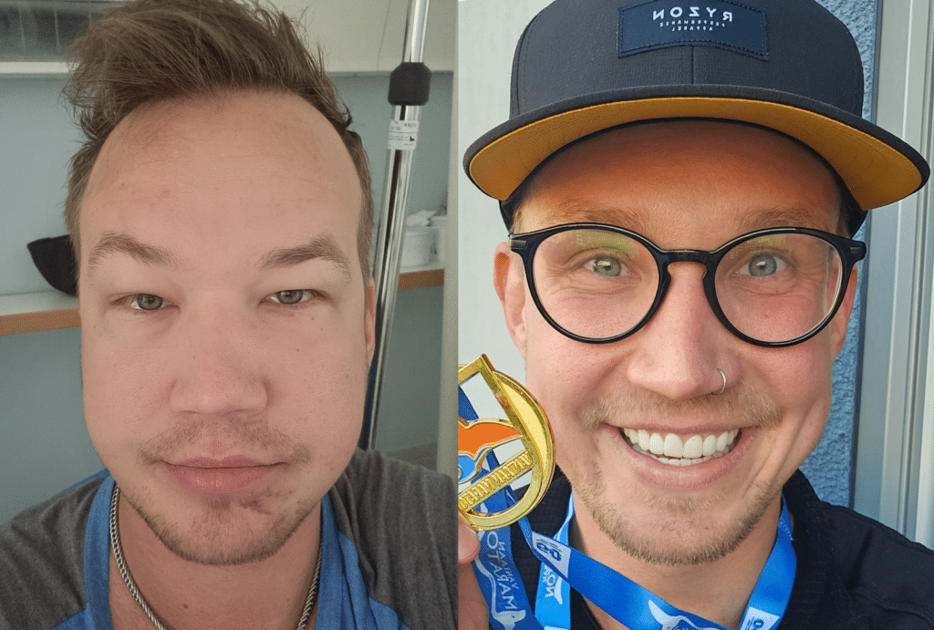 tuomas laine ennen ja jälkeen